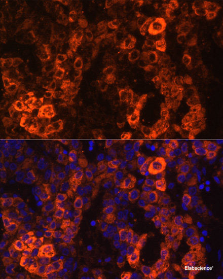 Immunofluorescence analysis of MCF7 cells using RAD51C Polyclonal Antibody