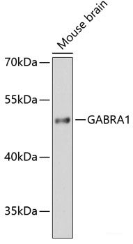 Immunofluorescence analysis of U2OS cells using SFRS9 Polyclonal Antibody at dilution of 1:100. Blue: DAPI for nuclear staining.