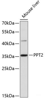 Immunofluorescence analysis of THP-1 cells using TNFRSF10A Polyclonal Antibody at dilution of 1:100 (40x lens). Blue: DAPI for nuclear staining.
