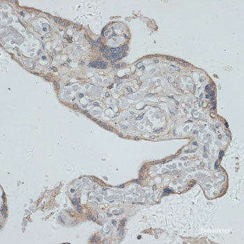 Immunohistochemistry of paraffin-embedded Mouse lung using ARHGEF2 Polyclonal Antibody at dilution of 1:100 (40x lens).