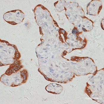 Immunohistochemistry of paraffin-embedded Human tonsil using Bim Polyclonal Antibody at dilution of 1:100 (40x lens).