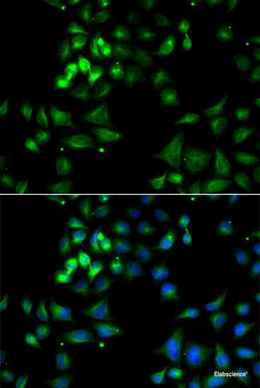 Immunohistochemistry of paraffin-embedded Mouse lung using CBX5 Polyclonal Antibody at dilution of 1:100 (40x lens).