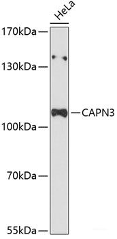 Western blot analysis of extracts of Rat liver using GHRL Polyclonal Antibody at dilution of 1:1000.
