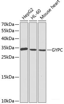 Immunohistochemistry of paraffin-embedded Human colon using METTL13 Polyclonal Antibody at dilution of 1:100 (40x lens).