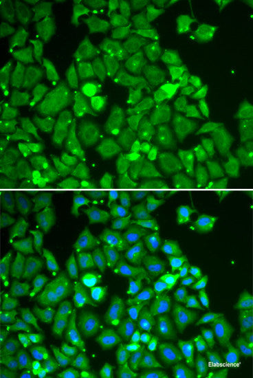Immunohistochemistry of paraffin-embedded Rat brain using MKL1 Polyclonal Antibody