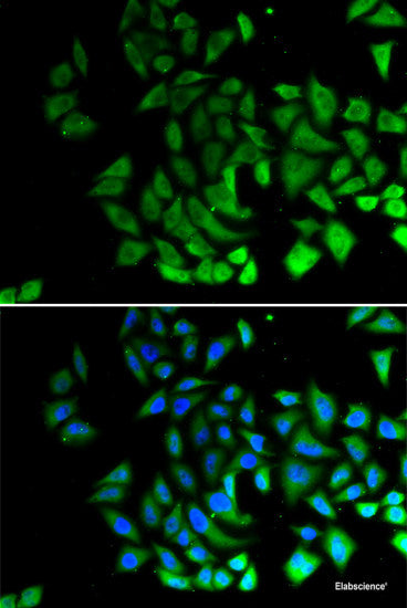 Immunohistochemistry of paraffin-embedded Mouse kidney using TIRAP Polyclonal Antibody at dilution of 1:100 (40x lens).