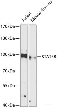 Immunohistochemistry of paraffin-embedded Human stomach using MICA Polyclonal Antibody at dilution of 1:100 (40x lens).