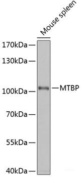 Immunofluorescence analysis of MCF-7 cells using COG2 Polyclonal Antibody