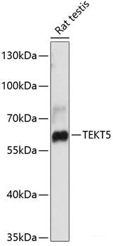 Western blot analysis of extracts of HeLa cells using NUCB2 Polyclonal Antibody at dilution of 1:3000.