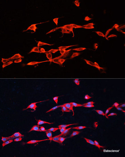 Western blot analysis of extracts of various cell lines using BRWD1 Polyclonal Antibody at dilution of 1:3000.