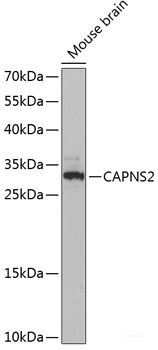 Western blot analysis of extracts of various cell lines using IFT74 Polyclonal Antibody at dilution of 1:3000.