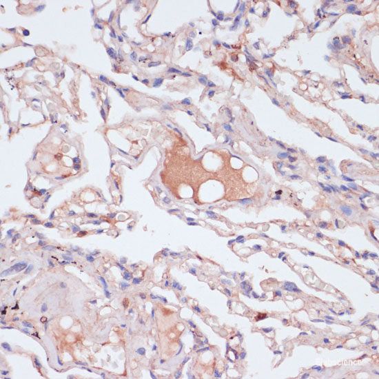 Immunohistochemistry of paraffin-embedded Rat brain using PAX7 Polyclonal Antibody at dilution of 1:100 (40x lens).