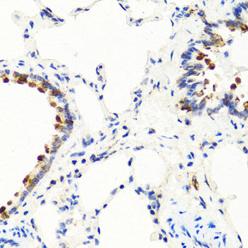 Western blot analysis of extracts of MCF7 cells using CSN2 Polyclonal Antibody at dilution of 1:3000.