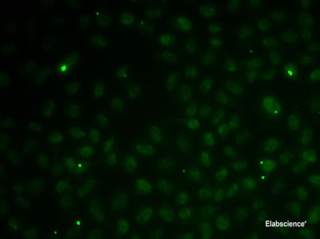 Western blot analysis of extracts of various cell lines using ONECUT1 Polyclonal Antibody at dilution of 1:3000.