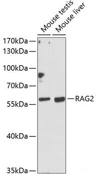 Immunofluorescence analysis of HeLa cells using WDR81 Polyclonal Antibody at dilution of 1:100. Blue: DAPI for nuclear staining.
