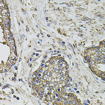 Immunofluorescence analysis of NIH-3T3 cells using ITPR3 Polyclonal Antibody at dilution of 1:100. Blue: DAPI for nuclear staining.
