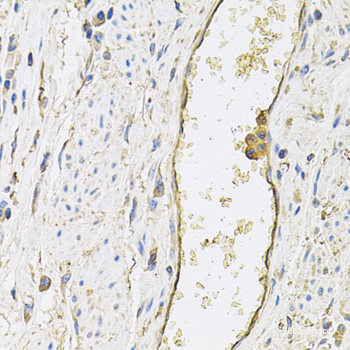 Immunofluorescence analysis of L929 cells using NOS1 Polyclonal Antibody at dilution of 1:100. Blue: DAPI for nuclear staining.