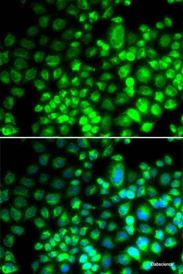 Immunohistochemistry of paraffin-embedded Human liver using ACOX2 Polyclonal Antibody at dilution of 1:100 (40x lens).
