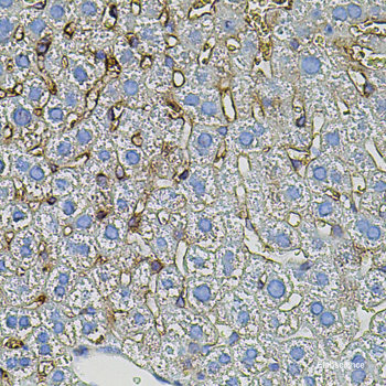 Immunohistochemistry of paraffin-embedded Rat brain using OLIG2 Polyclonal Antibody at dilution of 1:200 (40x lens).
