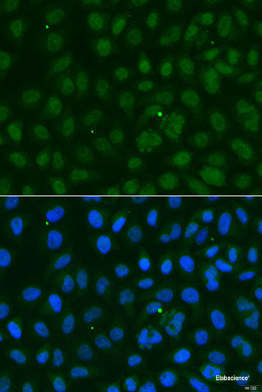 Western blot analysis of extracts of various cell lines using TCL1B Polyclonal Antibody at dilution of 1:3000.