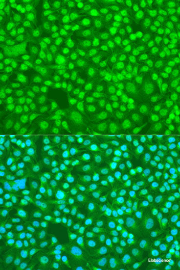 Western blot analysis of extracts of various cell lines using PPM1J Polyclonal Antibody at dilution of 1:3000.