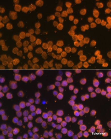 Immunofluorescence analysis of Rat kidney using SLC7A9 Polyclonal Antibody at dilution of 1:100. Blue: DAPI for nuclear staining.