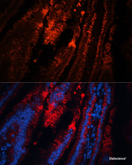 Immunohistochemistry of paraffin-embedded Rat spleen using TP53I11 Polyclonal Antibody at dilution of 1:100 (40x lens).