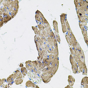 Immunohistochemistry of paraffin-embedded Human lung using C1GALT1 Polyclonal Antibody at dilution of 1:100 (40x lens).
