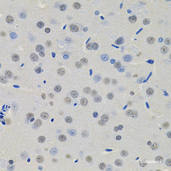 Western blot analysis of extracts of various cell lines using ZNF268 Polyclonal Antibody at dilution of 1:3000.