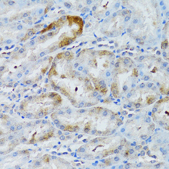 Immunohistochemistry of paraffin-embedded Rat kidney using LTF Polyclonal Antibody at dilution of 1:100 (40x lens).