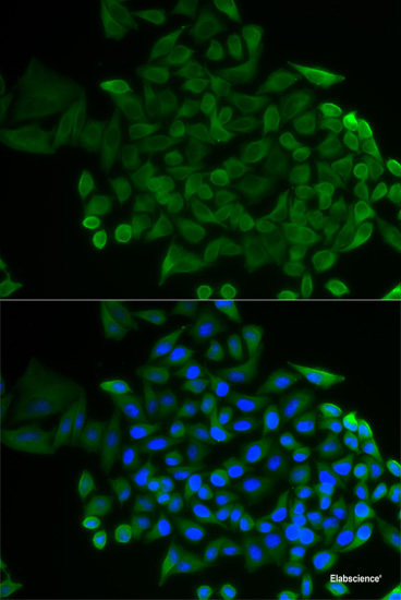 Western blot analysis of extracts of HepG2 cells using F5 Polyclonal Antibody at dilution of 1:1000.