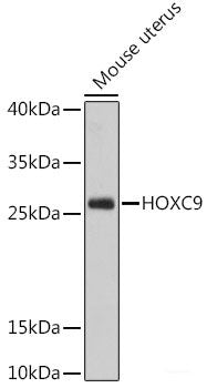 Western blot analysis of extracts of various cell lines using MCM8 Polyclonal Antibody at dilution of 1:3000.