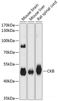 Western blot analysis of extracts of various cell lines using MRPS31 Polyclonal Antibody at dilution of 1:3000.