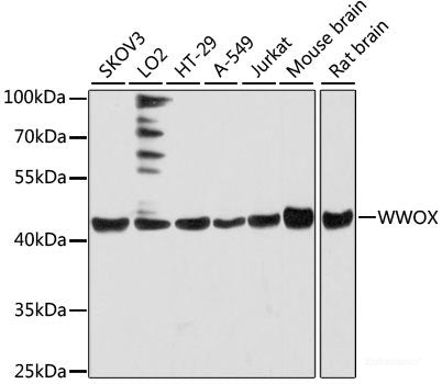 Western blot analysis of extracts of various cell lines using p63 Polyclonal Antibody at dilution of 1:3000.