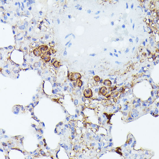 Immunofluorescence analysis of Rat heart using MYH6 Polyclonal Antibody at dilution of 1:100. Blue: DAPI for nuclear staining.