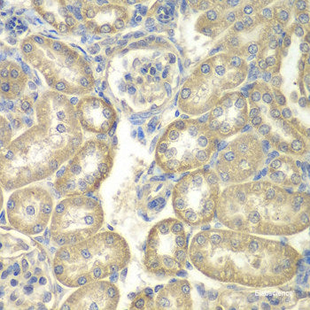 Immunofluorescence analysis of 293T cells using HNRNPH2 Polyclonal Antibody at dilution of 1:100 (40x lens). Blue: DAPI for nuclear staining.