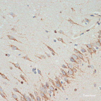 Western blot analysis of extracts of various cell lines using FLNC Polyclonal Antibody at dilution of 1:3000.