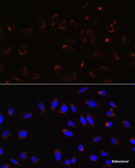 Western blot analysis of extracts of various cell lines using MYO6 Polyclonal Antibody at dilution of 1:3000.