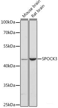 Immunohistochemistry of paraffin-embedded Rat ovary using A1CF Polyclonal Antibody at dilution of 1:100 (40x lens).