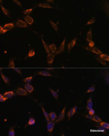Western blot analysis of extracts of Rat lung using ERRFI1 Polyclonal Antibody at dilution of 1:3000.