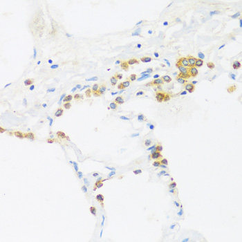 Immunofluorescence analysis of MCF-7 cells using HFE Polyclonal Antibody