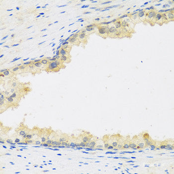 Western blot analysis of extracts of various cell lines using RCC2 Polyclonal Antibody at dilution of 1:3000.