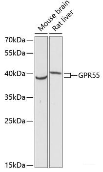 Immunofluorescence analysis of HeLa cells using USP36 Polyclonal Antibody at dilution of 1:100 (40x lens). Blue: DAPI for nuclear staining.