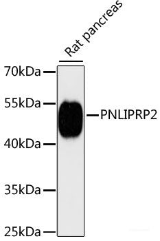 Western blot analysis of extracts of various cell lines using RBM26 Polyclonal Antibody at dilution of 1:3000.