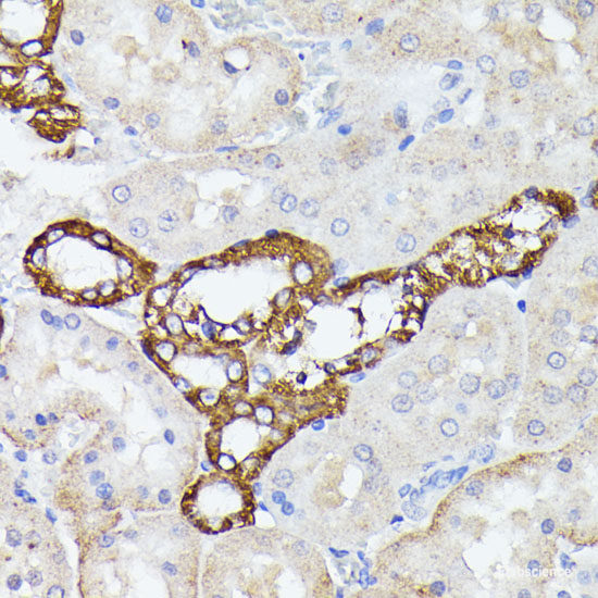 Immunohistochemistry of paraffin-embedded Human tonsil using MUL1 Polyclonal Antibody at dilution of 1:100 (40x lens).