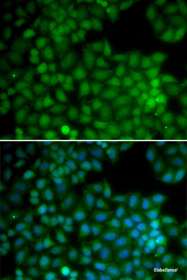 Western blot analysis of extracts of various cell lines using LRat Polyclonal Antibody at dilution of 1:3000.