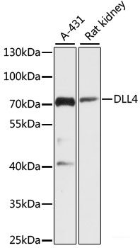 Western blot analysis of extracts of various cell lines using SCYL2 Polyclonal Antibody at dilution of 1:3000.