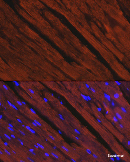 Western blot analysis of extracts of various cell lines using OSBPL10 Polyclonal Antibody at dilution of 1:3000.