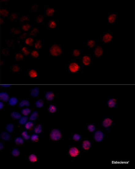 Immunohistochemistry of paraffin-embedded Rat brain using SLC29A1 Polyclonal Antibody at dilution of 1:100 (40x lens).