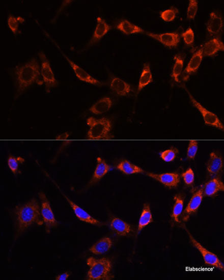 Western blot analysis of extracts of various cell lines using RPS19BP1 Polyclonal Antibody at dilution of 1:3000.